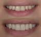 Slider image (10) UltimaDent